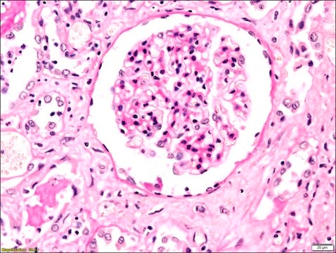 PAS TISSUE-TROL&#8482; Control Slides from human kidney