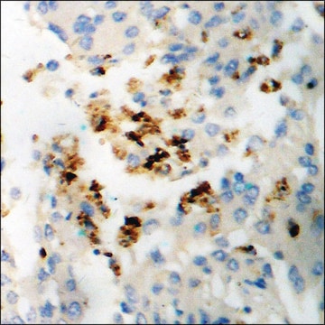 Anti-phospho-SGK (pSer422) antibody produced in rabbit affinity isolated antibody