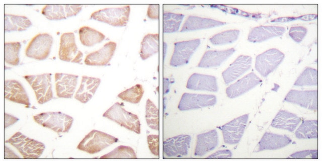 Anti-AKT antibody produced in rabbit affinity isolated antibody