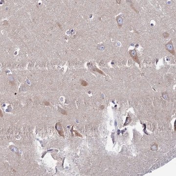 Anti-CLCN3 antibody produced in rabbit Prestige Antibodies&#174; Powered by Atlas Antibodies, affinity isolated antibody, buffered aqueous glycerol solution