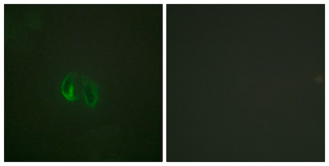 Anti-IL-10R &#945; antibody produced in rabbit affinity isolated antibody