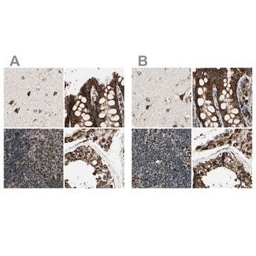 Anti-ME2 antibody produced in rabbit Prestige Antibodies&#174; Powered by Atlas Antibodies, affinity isolated antibody, buffered aqueous glycerol solution