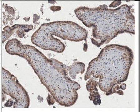 Anti-Lipoprotein Lipase Antibody, clone 5D2 clone 5D2, from mouse