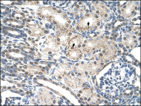 Anti-PRPF19 (AB2) antibody produced in rabbit IgG fraction of antiserum