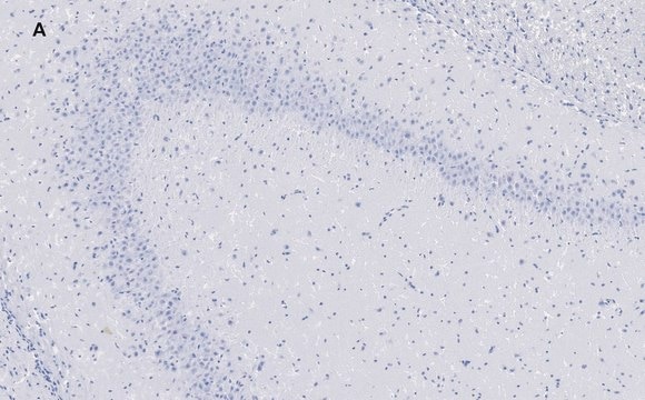 Anti-GluR2 Antibody, clone 1K4, ZooMAb&#174; Rabbit Monoclonal recombinant, expressed in HEK 293 cells