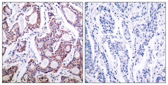 Anti-NF-&#954;B p100 antibody produced in rabbit affinity isolated antibody