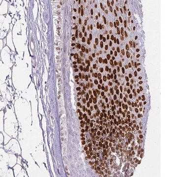 Anti-HOXC13 antibody produced in rabbit Prestige Antibodies&#174; Powered by Atlas Antibodies, affinity isolated antibody, buffered aqueous glycerol solution