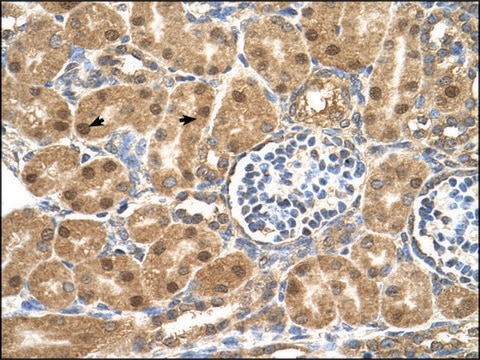 Anti-PTGDS antibody produced in rabbit affinity isolated antibody