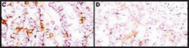 Monoclonal Anti-Mesothelin antibody produced in mouse clone MB-G10, purified immunoglobulin