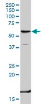 Anti-TNFRSF1B antibody produced in rabbit purified immunoglobulin, buffered aqueous solution