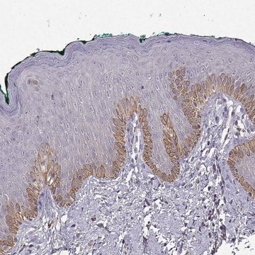 Anti-TACR1 antibody produced in rabbit Prestige Antibodies&#174; Powered by Atlas Antibodies, affinity isolated antibody