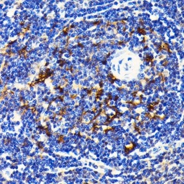 Anti- SQSTM1/p62 antibody produced in rabbit