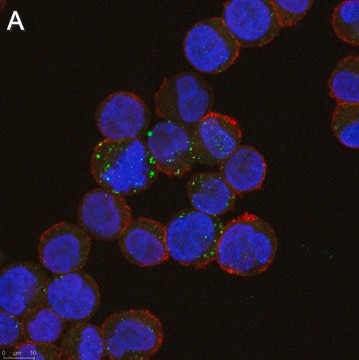 Anti-ULBP1 Antibody, clone 6B17 ZooMAb&#174; Rabbit Monoclonal recombinant, expressed in HEK 293 cells