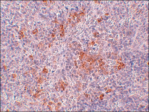 Anti-AGTR1 antibody produced in rabbit affinity isolated antibody, buffered aqueous solution