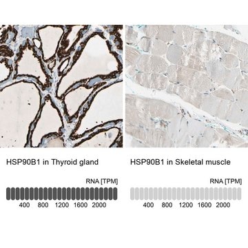 Anti-HSP90B1 antibody produced in rabbit Prestige Antibodies&#174; Powered by Atlas Antibodies, affinity isolated antibody, buffered aqueous glycerol solution