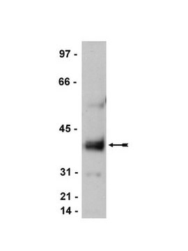 Anti-Stargazin/Cacng2 Antibody, CT Upstate&#174;, from rabbit