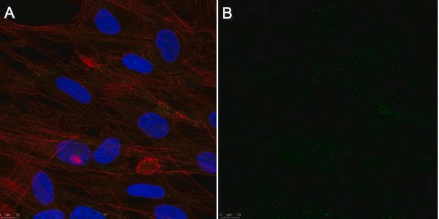 Anti-Cytomegalovirus Antibody, clone 8B1.2 clone 8B1.2, Chemicon&#174;, from mouse