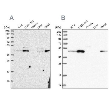 Anti-ZDHHC16 antibody produced in rabbit Prestige Antibodies&#174; Powered by Atlas Antibodies, affinity isolated antibody