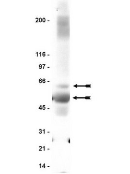 Anti-GABA A Receptor &#946;2/3 Antibody clone 62-3G1, Upstate&#174;, from mouse