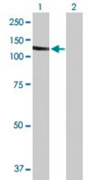 Anti-SLC4A1 antibody produced in mouse purified immunoglobulin, buffered aqueous solution