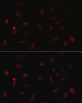 Anti-PAX6 antibody produced in rabbit