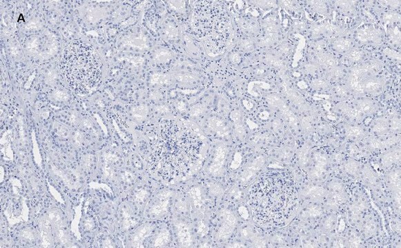 Anti-Nestin Antibody, clone 8B8, ZooMAb&#174; Rabbit Monoclonal recombinant, expressed in HEK 293 cells