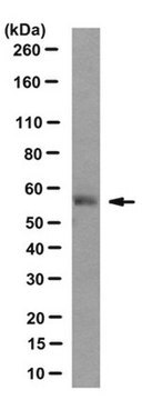 Anti-HOIL-1 Antibody, clone 2E2 clone 2E2, from mouse