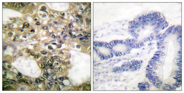 Anti-HDAC6 antibody produced in rabbit affinity isolated antibody