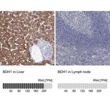 Anti-BDH1 antibody produced in rabbit Prestige Antibodies&#174; Powered by Atlas Antibodies, affinity isolated antibody, buffered aqueous glycerol solution