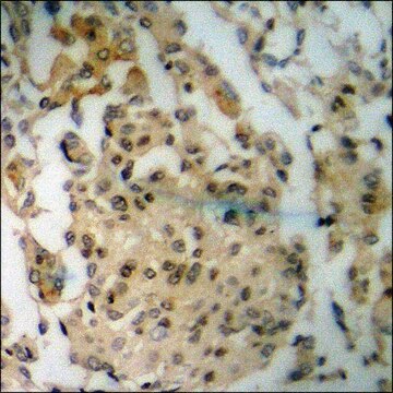 Anti-phospho-NMDAR2B (pTyr1336) antibody produced in rabbit affinity isolated antibody