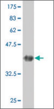 ANTI-GUCY2C antibody produced in mouse clone 1D11, purified immunoglobulin, buffered aqueous solution