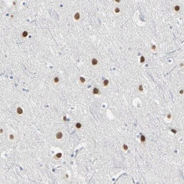 Anti-ZIC1 antibody produced in rabbit affinity isolated antibody, buffered aqueous glycerol solution