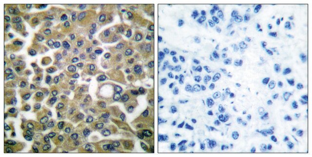 Anti-Keratin 16 antibody produced in rabbit affinity isolated antibody