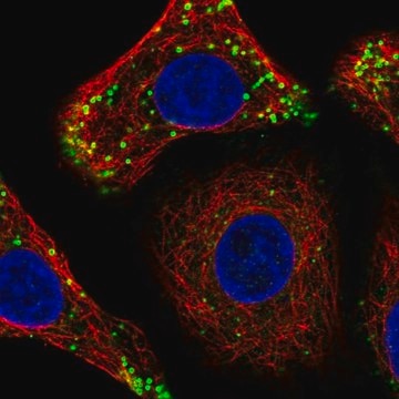 Anti-CTDNEP1 antibody produced in rabbit Prestige Antibodies&#174; Powered by Atlas Antibodies, affinity isolated antibody