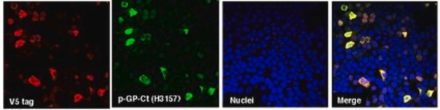 Anti-C9ORF72/C9RANT (GPsense-CT) serum, from rabbit