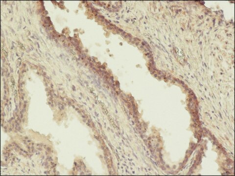 Monoclonal Anti-Phosphothreonine antibody produced in mouse clone PTR-8, ascites fluid