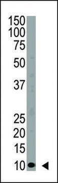 ANTI-UBIQUITIN(N-TERMINAL) antibody produced in rabbit IgG fraction of antiserum, buffered aqueous solution