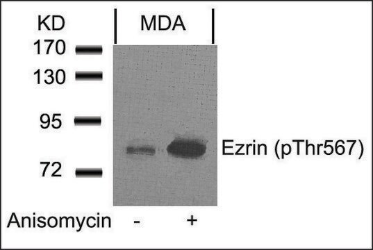 Anti-phospho-EZR (pThr567) antibody produced in rabbit affinity isolated antibody