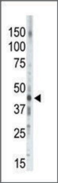 Anti-PKA/C&#947; (N-term) antibody produced in rabbit IgG fraction of antiserum, buffered aqueous solution