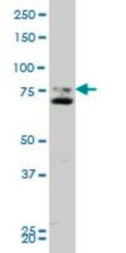 Monoclonal Anti-SMO, (C-terminal) antibody produced in mouse clone 1D9, purified immunoglobulin, buffered aqueous solution