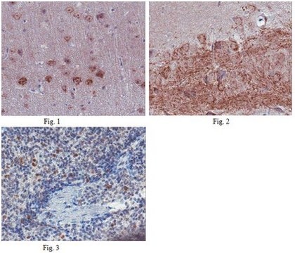 Anti-C-X-C chemokine receptor type 5 (CXCR5) Antibody from rabbit, purified by affinity chromatography