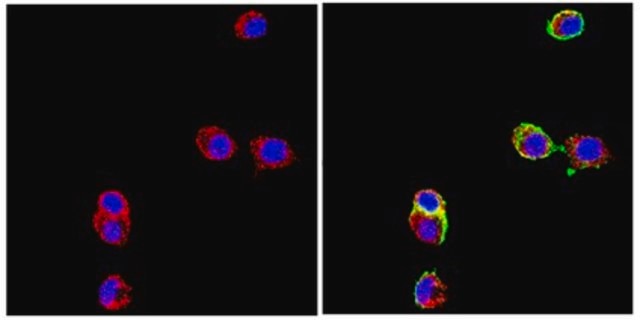 Anti-Neural Cell Adhesion Molecule L1 Antibody, clone 324 clone 324, Chemicon&#174;, from rat