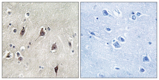 Anti-p70 S6 Kinase antibody produced in rabbit affinity isolated antibody