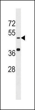 ANTI-KREMEN(N-TERMINAL) antibody produced in rabbit IgG fraction of antiserum, buffered aqueous solution