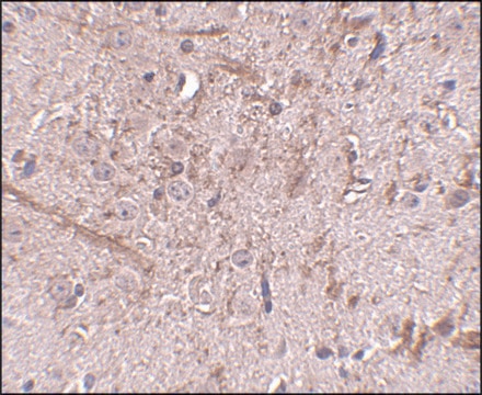 Anti-TOM70 antibody produced in rabbit affinity isolated antibody, buffered aqueous solution