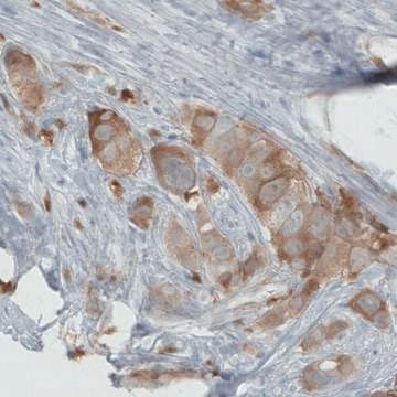 Monoclonal Anti-PHGDH antibody produced in mouse Prestige Antibodies&#174; Powered by Atlas Antibodies, clone CL0555, purified immunoglobulin, buffered aqueous glycerol solution