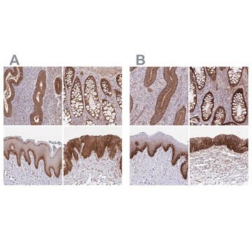 Anti-ITGA2 antibody produced in rabbit Prestige Antibodies&#174; Powered by Atlas Antibodies, affinity isolated antibody, buffered aqueous glycerol solution