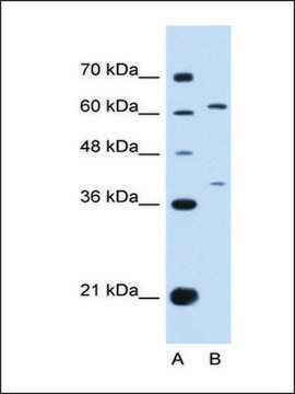 Anti-IL28RA antibody produced in rabbit affinity isolated antibody