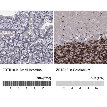 Anti-ZBTB18 antibody produced in rabbit Prestige Antibodies&#174; Powered by Atlas Antibodies, affinity isolated antibody, buffered aqueous glycerol solution