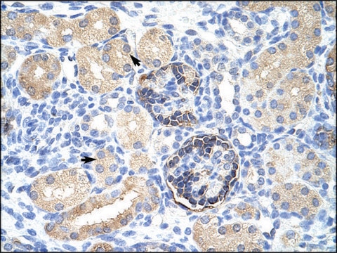 Anti-CLIC5 antibody produced in rabbit affinity isolated antibody